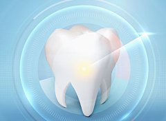 關於牙齒美白的5個常見問題解答！