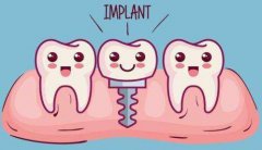 半口種牙優勢有邊D呢？需要注意邊D？