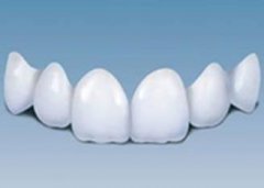 全瓷牙固定修復的優勢