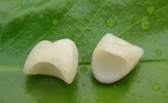 全瓷牙修復效果好唔好呢？