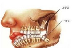 智慧牙要mok嗎？有冇人知