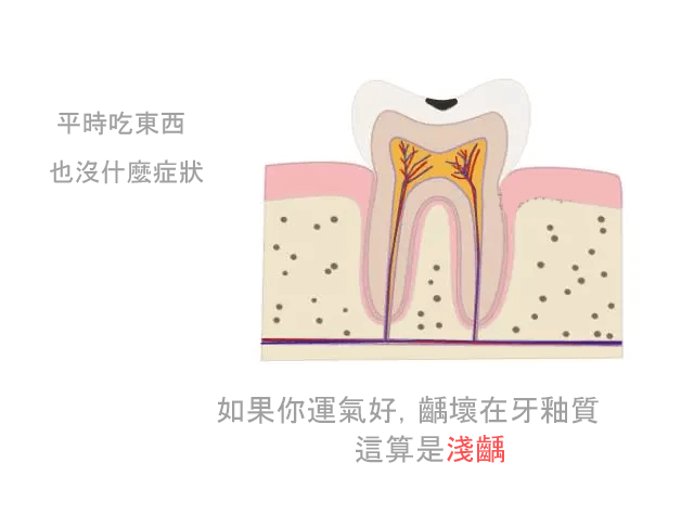 牙痛快速止痛方法