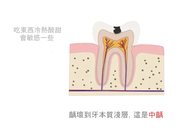 牙痛快速止痛方法