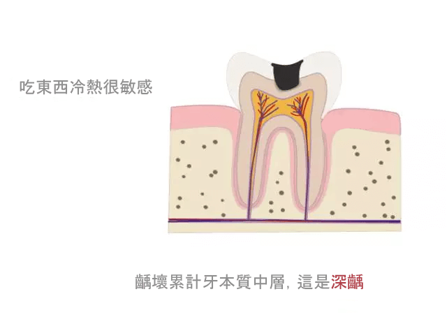 牙痛快速止痛方法