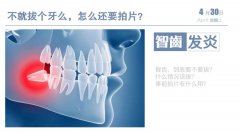 不就拔個牙么，怎麼還要拍片？