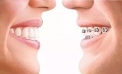 牙齒不齊•影響健康