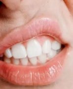 如何維護自己的口腔衛生