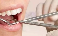 拔完牙為什麼不能吐口水？