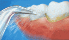 洗牙，是一種生活態度