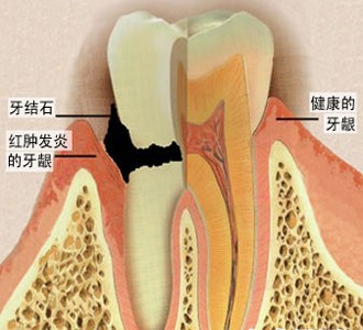 你的牙  痛屬於哪一種？