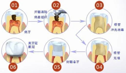 杜牙根風險