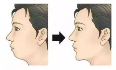 美學揭秘，如何判斷一個人好看與否？ 