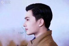 8個醫生案例 |箍牙拯救你的「沒下巴」！