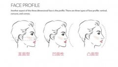 牙齒矯正對一個人的外貌究竟有多大影響？ 