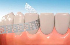 醫生說的片切、擴弓、拔牙、磨牙遠移，到底是什麼？