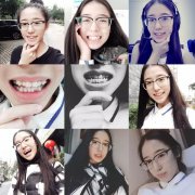 為什麼要在最美好的年紀戴牙套？