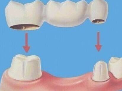 牙齒攝入氣量是越多越好嗎？