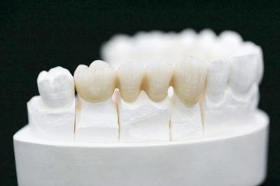種植牙能用多長時間？